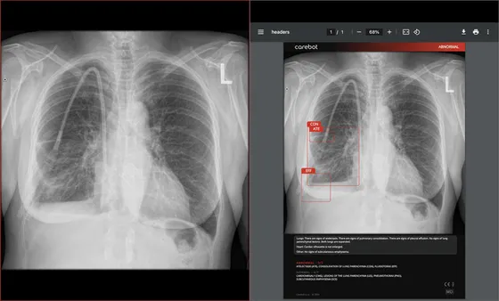 Screenshot carebot