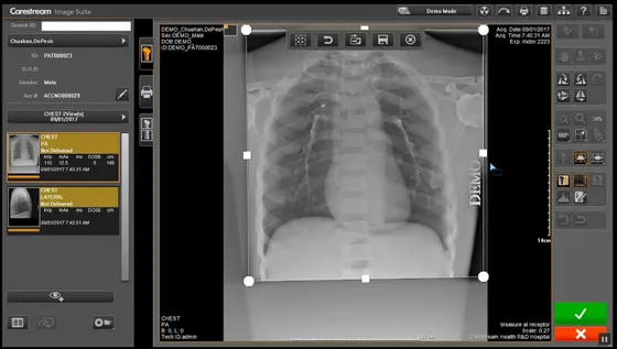Screenshot Carestream Health