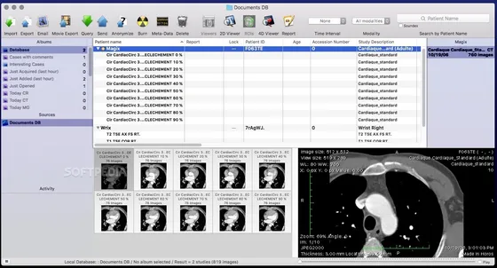 Screenshot Horos