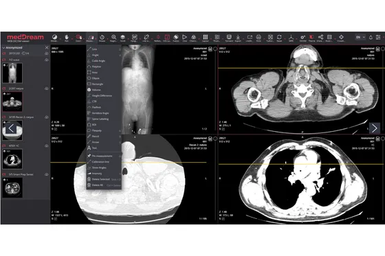 Screenshot medDream