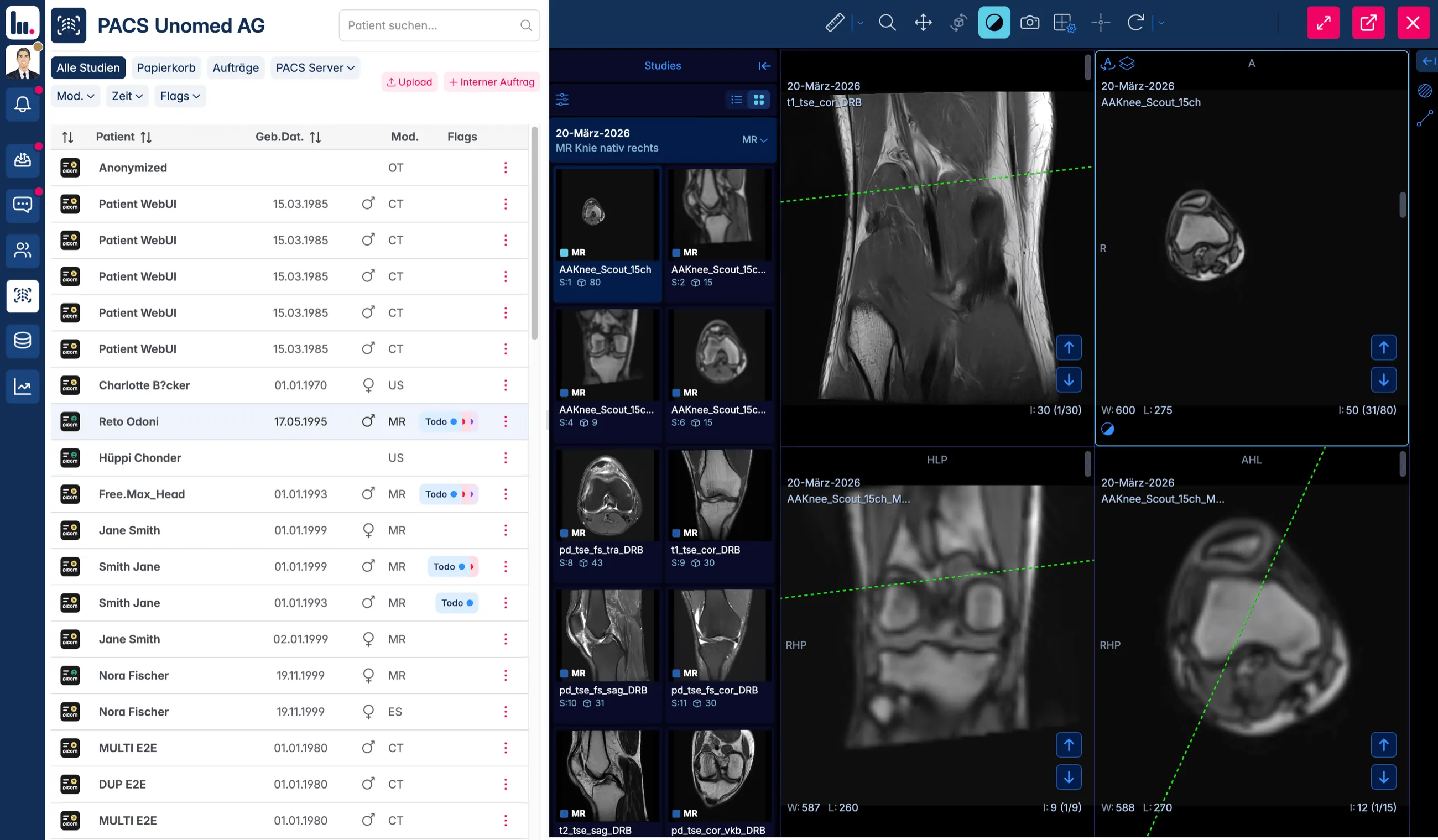 Unomed Cloud PACS in the browser: the study list with modality, date of birth and status on the left, the viewer showing an MR knee examination in four panes on the right.