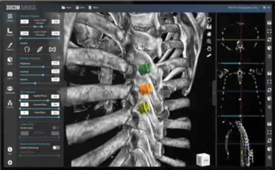 Screenshot 3DICOM Viewer