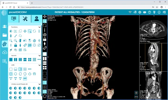 Screenshot postDICOM