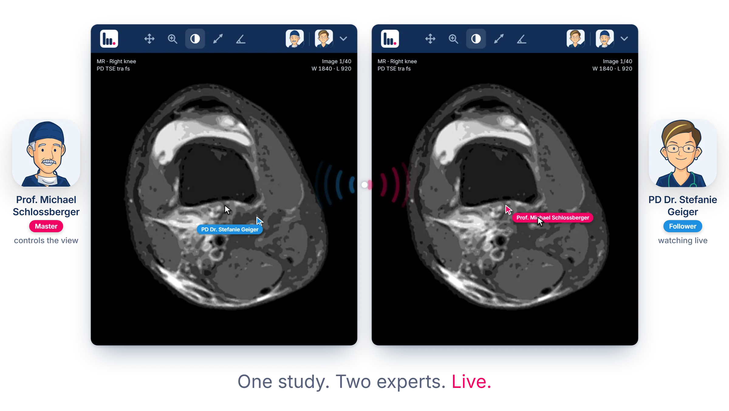 Unomed UNOBOARD: Prof. Michael Schlossberger and PD Dr. Stefanie Geiger report on the same knee MRI at the same time, each in their own viewer, with both cursors visible.