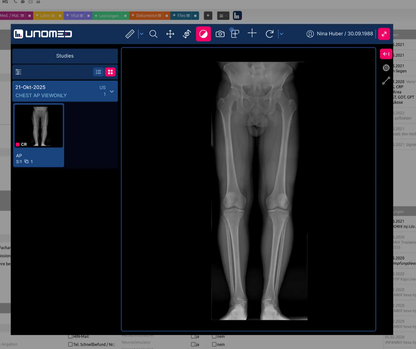 The viewer in Unomed showing a full-leg X-ray, with the series overview of the open study on the left.