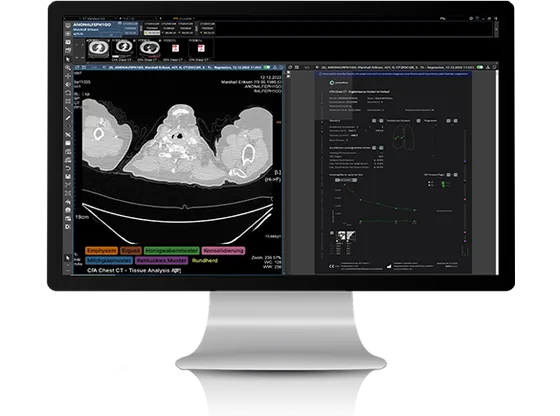 Screenshot INFINITT Healthcare