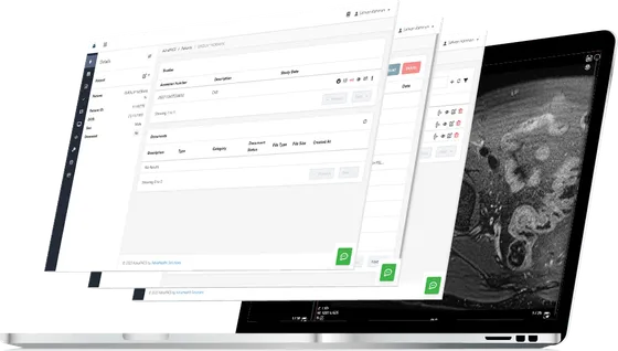 Screenshot ADVApacs