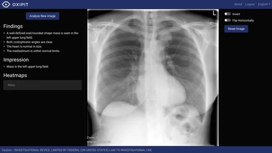 Screenshot Oxipit